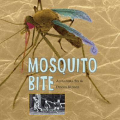 Mosquito bite 