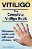 Go to record Vitiligo : vitiligo causes, remedies, costs and treatment ...